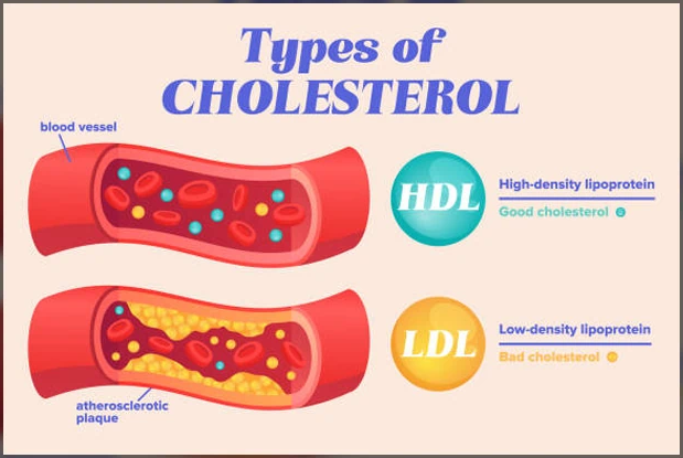 understand the types of cholesterol before even considering what is the best Natural Cholesterol Lowering Supplement