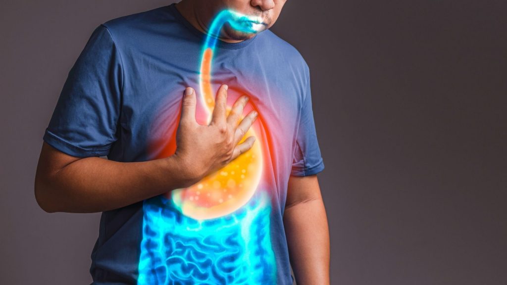 What is the best natural supplement for acid reflux?